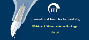ITI International Team for Implantology Webinar & Video Lectures