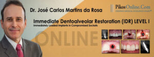 Immediate Dentoalveolar Restoration (IDR) Level 1