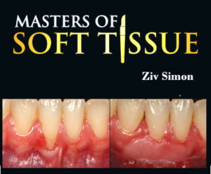 Masters of Soft Tissue – Ziv Simon
