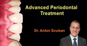 Advanced periodontal treatment