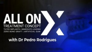 All On X Treatment Concept