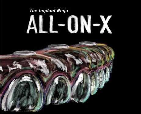 The All-on-X Course (Full Arch Implants)