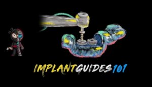 The Implant Guides 101 Course