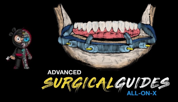 Implant Ninja Advanced Surgical Guides All On X Dental Courses 6618