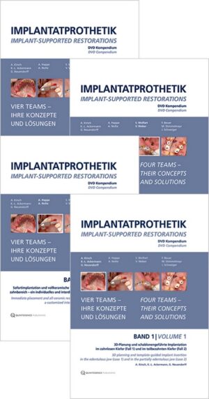 Implant-Supported Restorations - Vol. 1- 4 - (Video Course)
