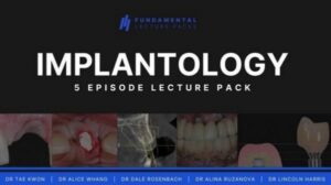 Implantology