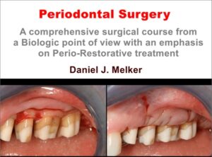 Periodontal Surgery