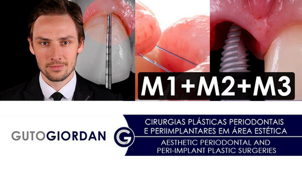 Aesthetic Periodontal and Peri-Implant Plastic Surgeries