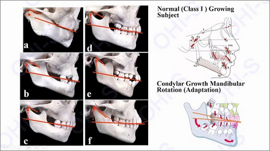 RESTORATIVE DESIGN & PRACTICAL OCCLUSIO… OD-1.jpg