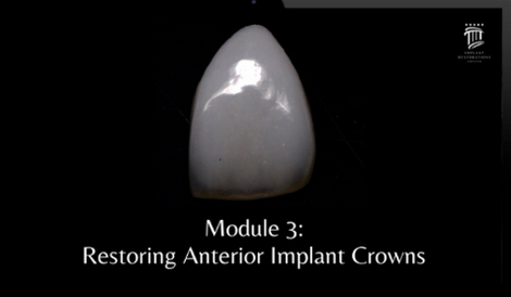 Implant Restorations Simplified: Restore Dental Implants with Accuracy ...