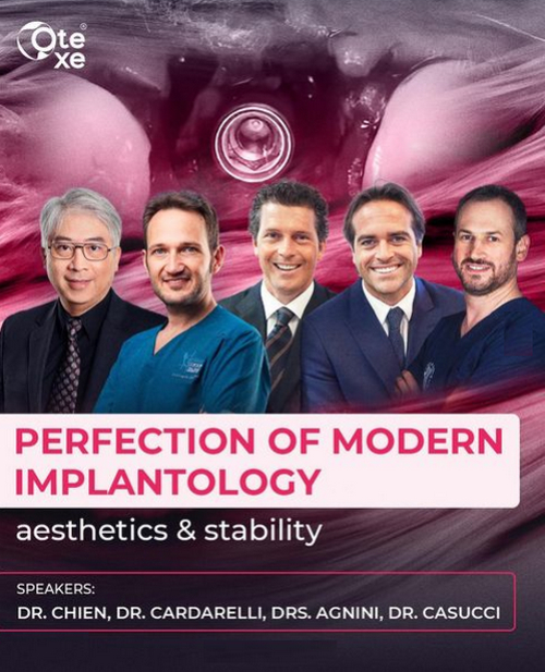 Perfection Of Modern Implantology