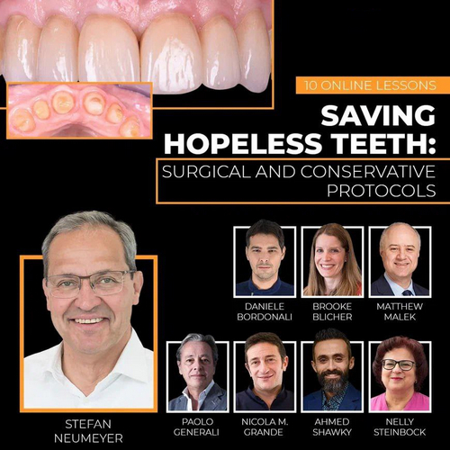 Saving Hopeless Teeth