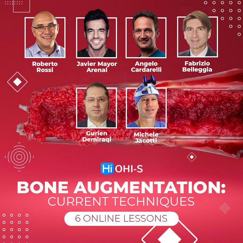 Bone Augmentation