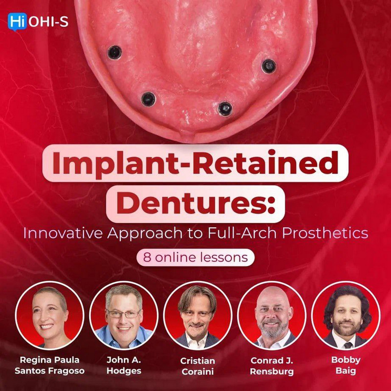 Implant-Retained Dentures