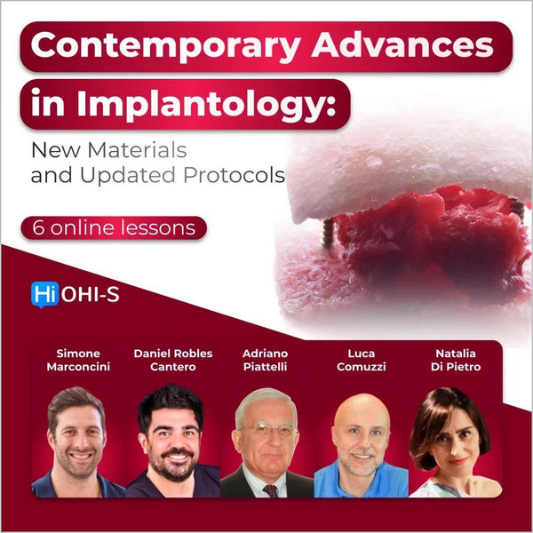 Contemporary Advances in Implantology