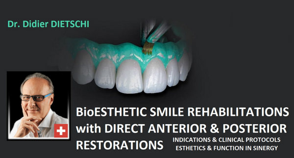 BioEsthetic Smile Rehabilitations with Direct Anterior & Posterior Restorations