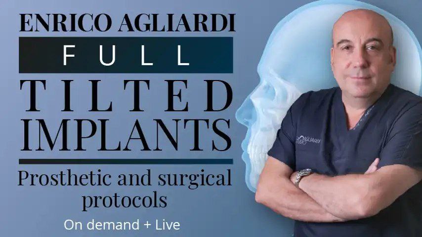 Full Tilted Implants