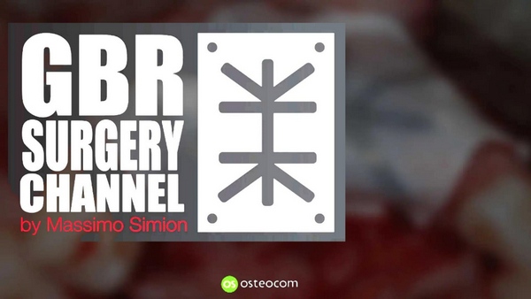 GBR Surgery Channel (International) - Massimo Simion