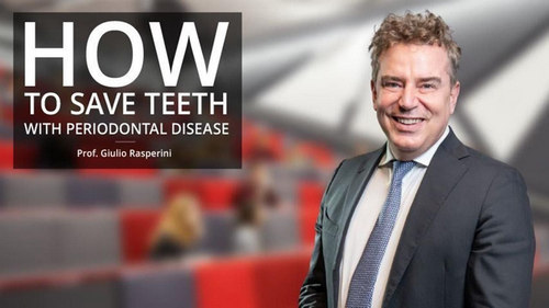 How To Save Teeth With Periodontal Disease