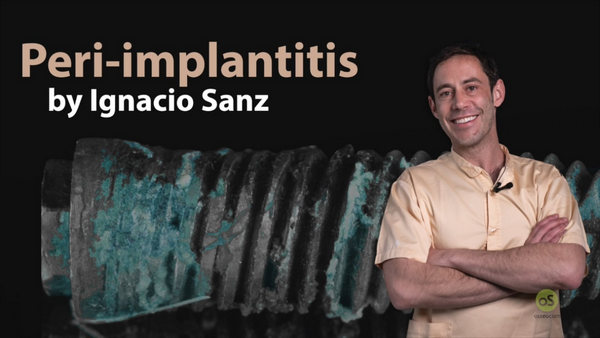 Peri-Implantitis