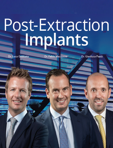 Post-Extraction Implants (Video course)