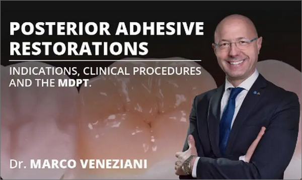 Posterior Adhesive Restorations