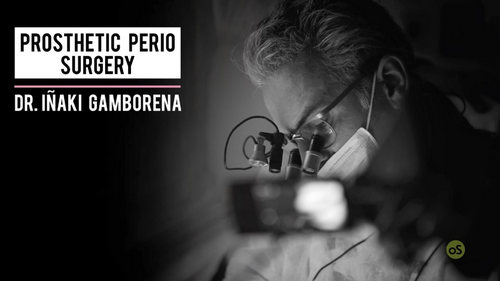 Prosthetic Perio Surgery (video course)