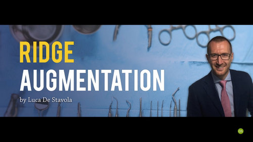 Ridge Augmentation – LucaDe Stavola