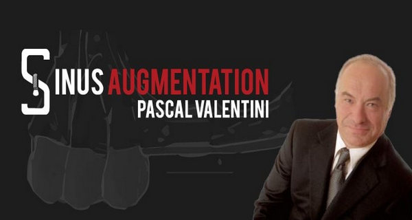 Sinus Augmentation International