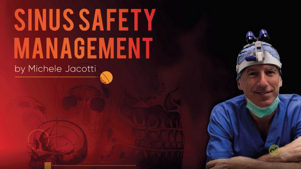 Sinus Safety Management (Sinus Floor Augmentation)
