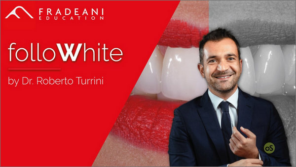 Follow White International- Tooth Whitening