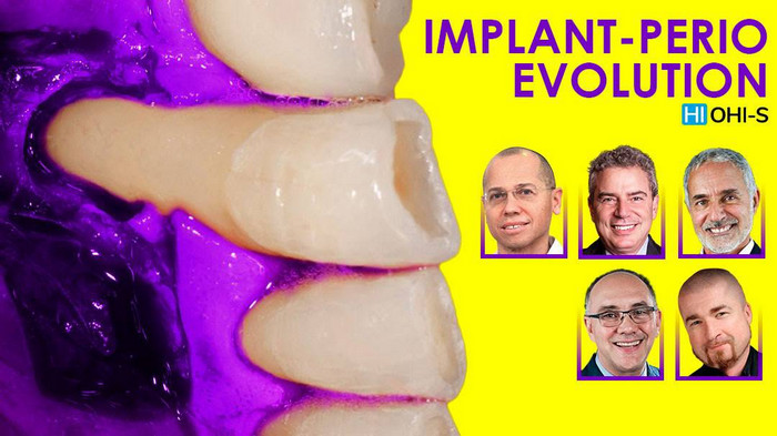 Implant-Perio Evolution