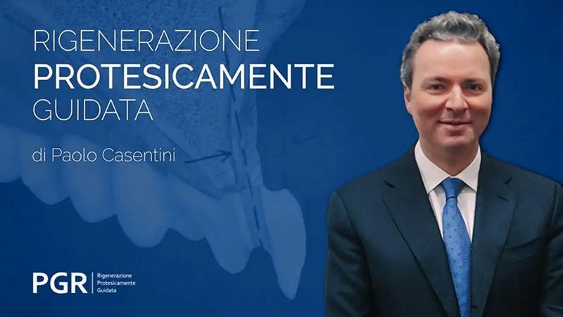 PGR Rigenerazione Protesicamente Guidata