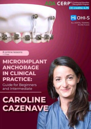 Microimplant Anchorage in Clinical Practice: Guide for Beginners and Intermediate