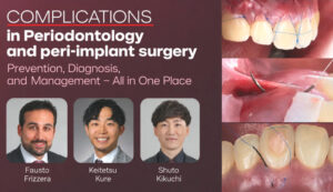 Complications in Periodontology and Peri-implant Surgery Prevention, Diagnosis, and Management – All in One Place
