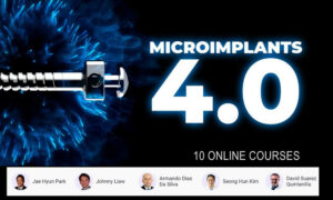 Microimplants 4.0