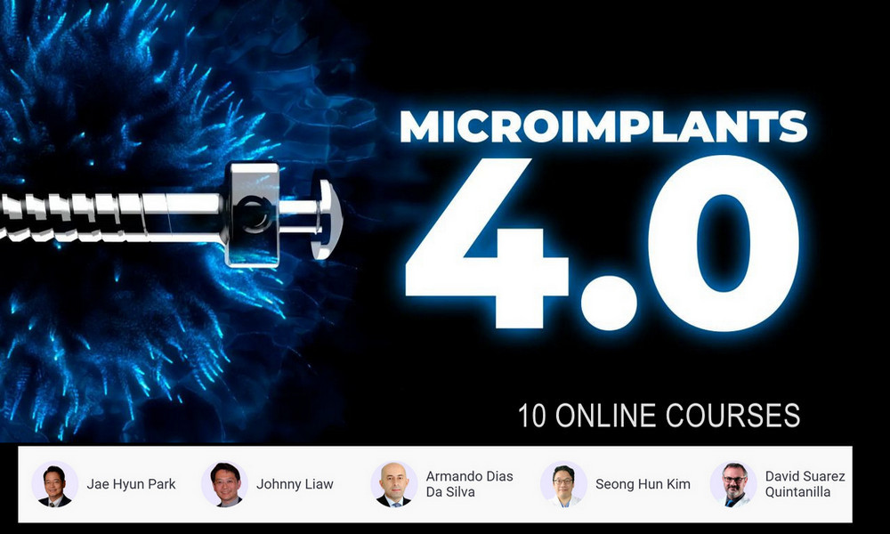 Microimplants 4.0